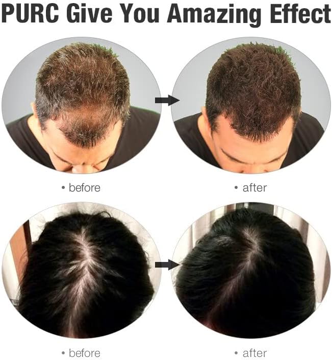 2 бр 300ml сгъстяване на коса, шампоан за мъже за жени дълбок фоликула на кожата на главата Лечение на анти-капка допринася за растежа